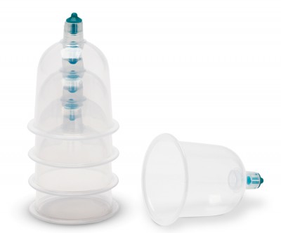 Einweg-Schröpfglas mit Ventil, Gr. S/3,2 cm, 5 St. Medizinprodukt Klasse 1