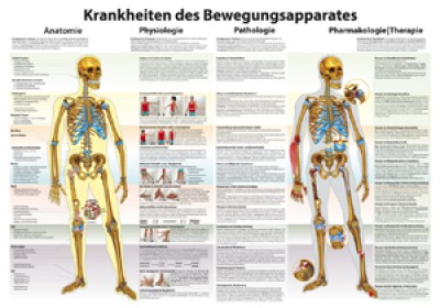 Karte Krankheiten des Bewegungsapparats Format 70x100cm