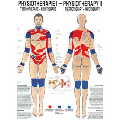 Mini-Poster Thermo-Therapie Format 23 x 33 cm *