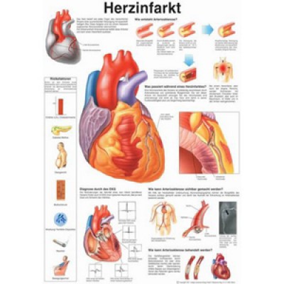 Poster Herzinfarkt, Format 50x70cm *