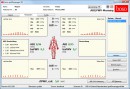 boso ABI-System-100 mit PWV-Messung