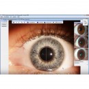 Irisdiagnose Premium-Paket bestehend aus: 826;8261;96295;0151;82631